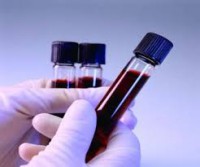 /album/ibop-laboratorio-/images-13-jpg1/